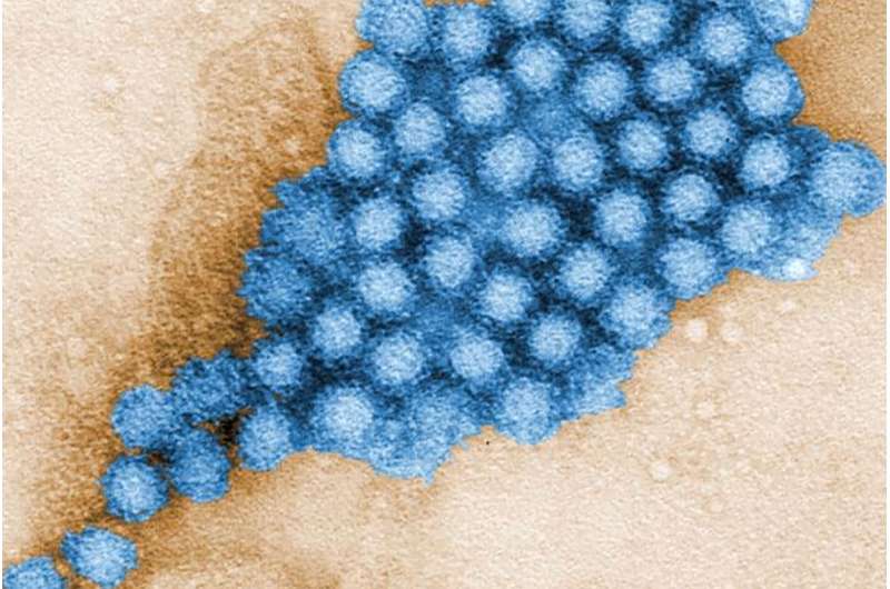 Gut microbes alter characteristics of norovirus infection