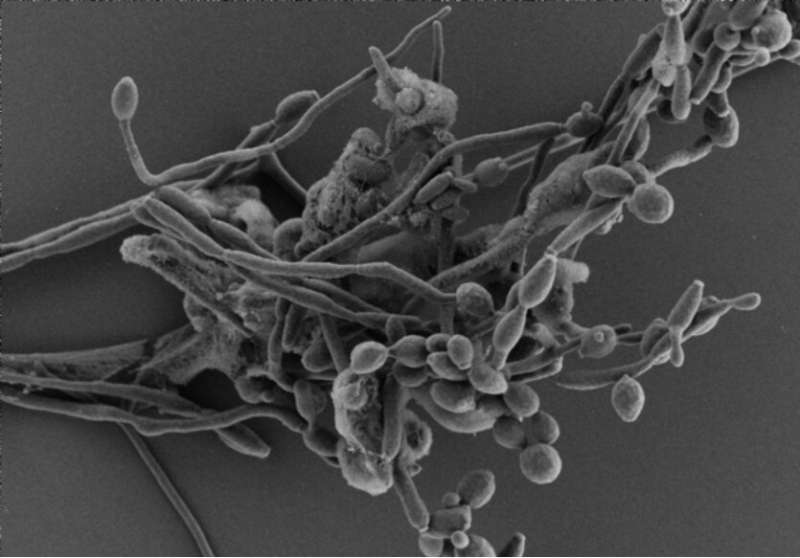 How Candida albicans exploits lack of oxygen to cause disease