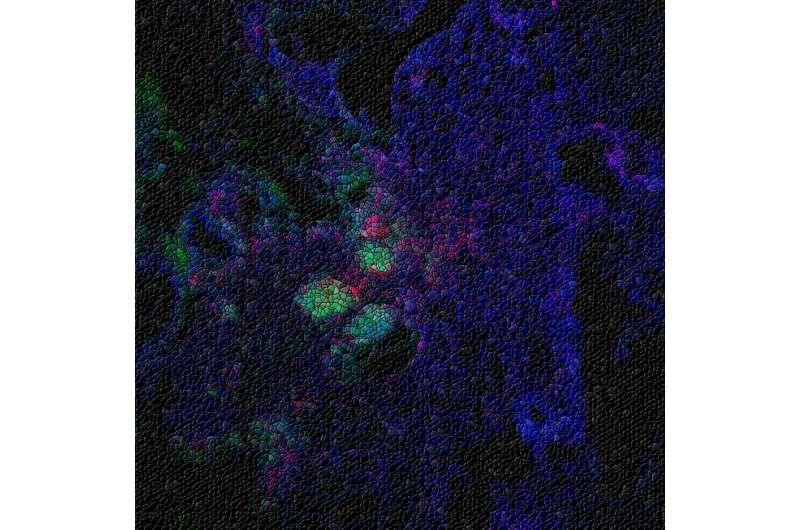 How lung tissue forms immune cell hubs in times of need