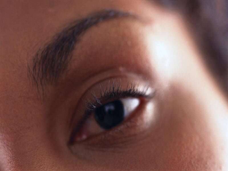 How to relieve dry, irritated eyes