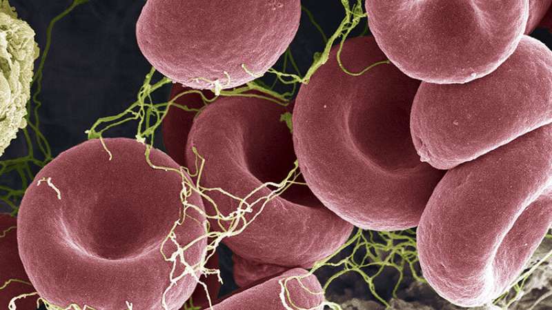Impeding white blood cells in antiphospholipid syndrome reduced blood clots