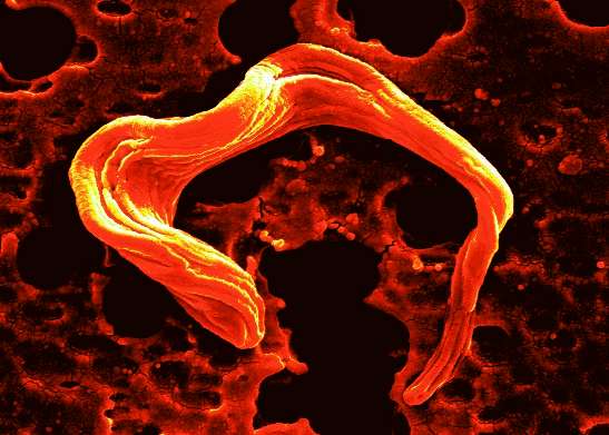 Insight into the neglected tropical disease sleeping sickness