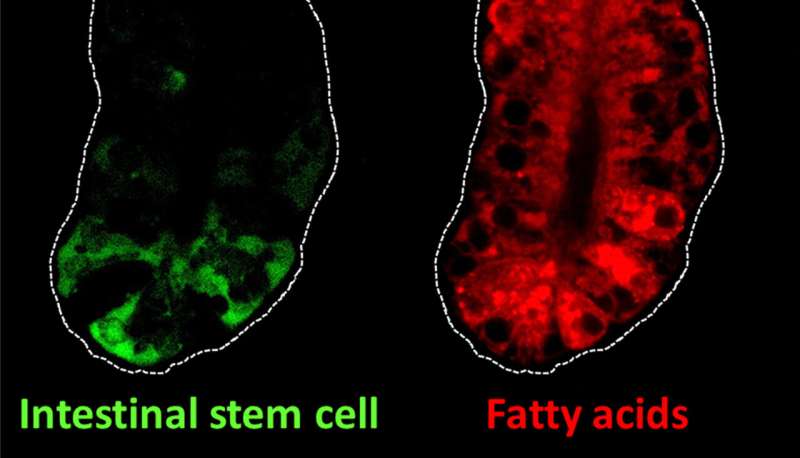 Intestinal stem cell genes may link dietary fat and colon cancer