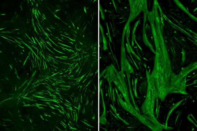 Lithium boosts muscle strength in mice with rare muscular dystrophy