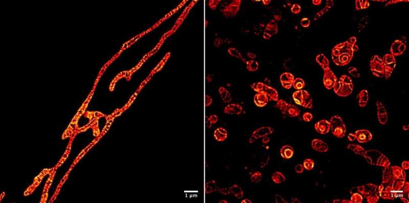 Live mitochondria seen in unprecedented detail: photobleaching in STED microscopy overcome