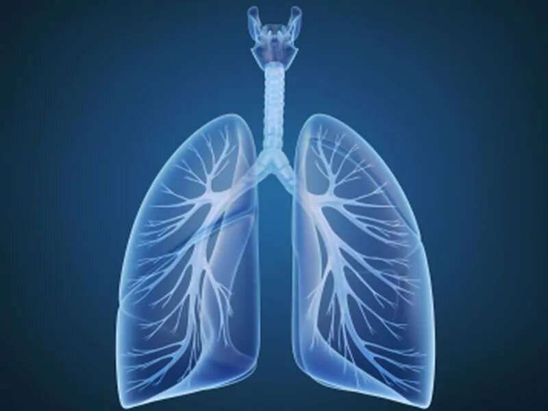Lung transplant with ex vivo lung perfusion feasible