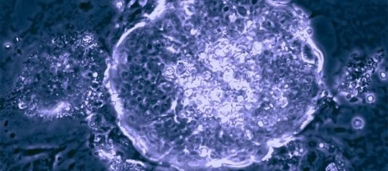 Major stem cell discovery to boost research into development and regenerative medicine