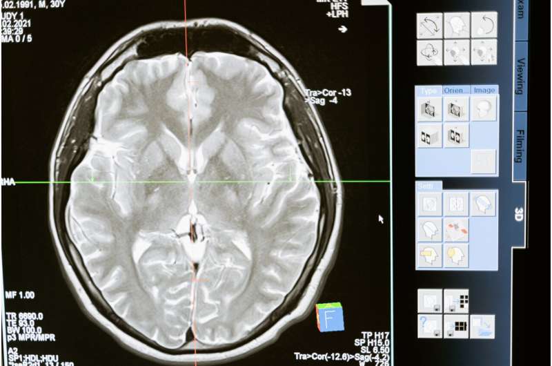 MRI scans reveal how brain protects memories