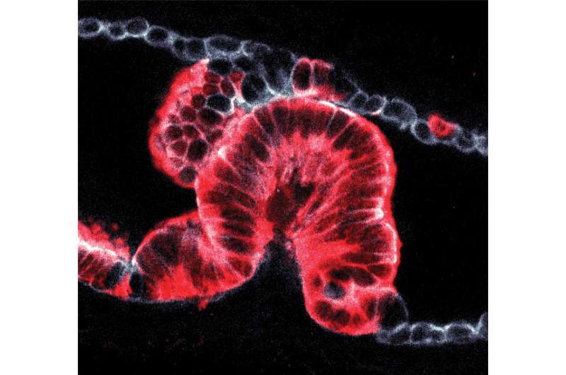 New 3D imaging technique reveals how pancreatic cancers start