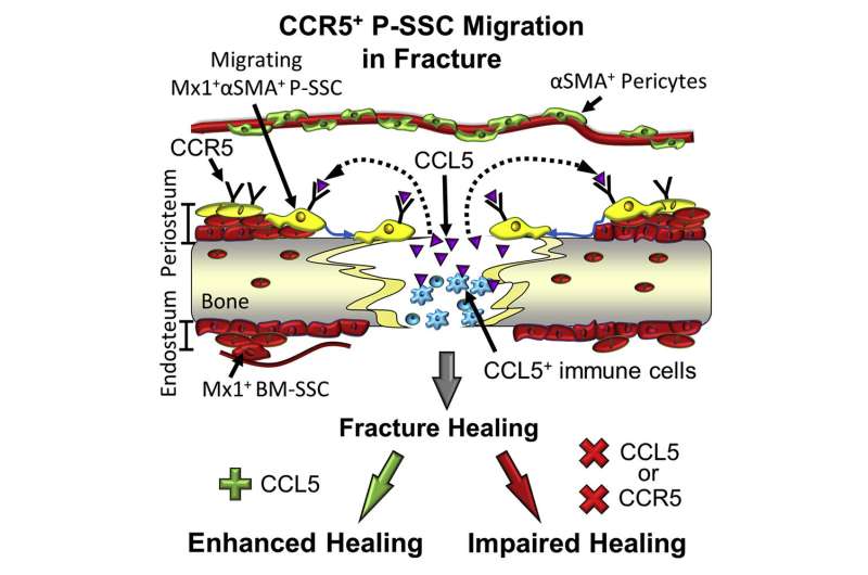New bone healing mechanism has potential therapeutic applications