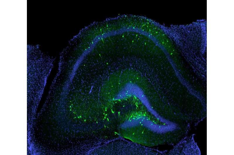 New cell therapy improves memory and stops seizures following TBI