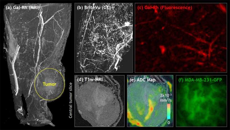 New contrast agent combination could usher in a new era of vascular systems biology