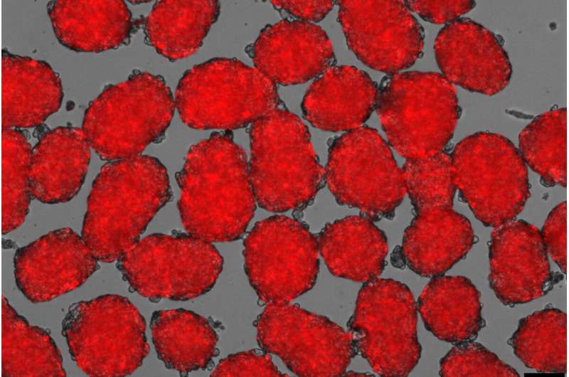 New hope for stem cell approach to treating diabetes