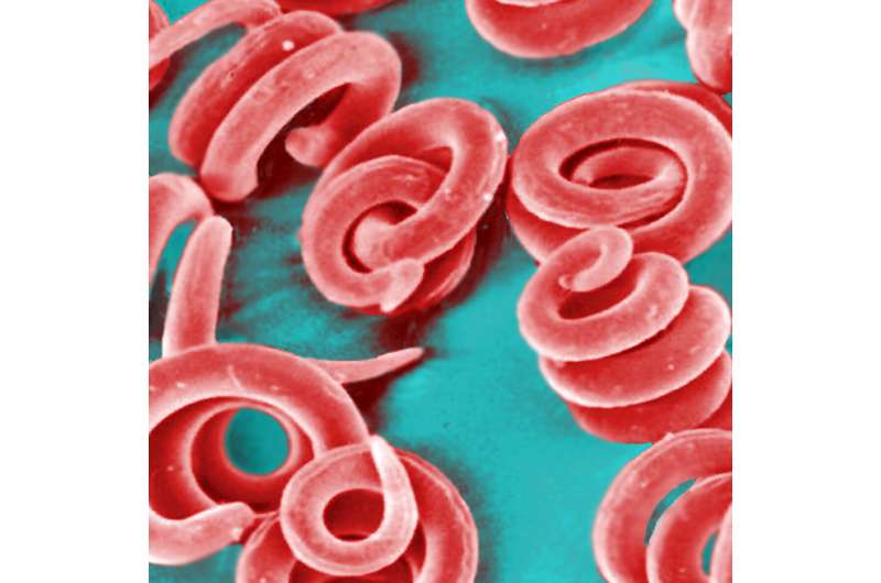 New immune pathway involved in resistance to parasite worms found in undercooked pork