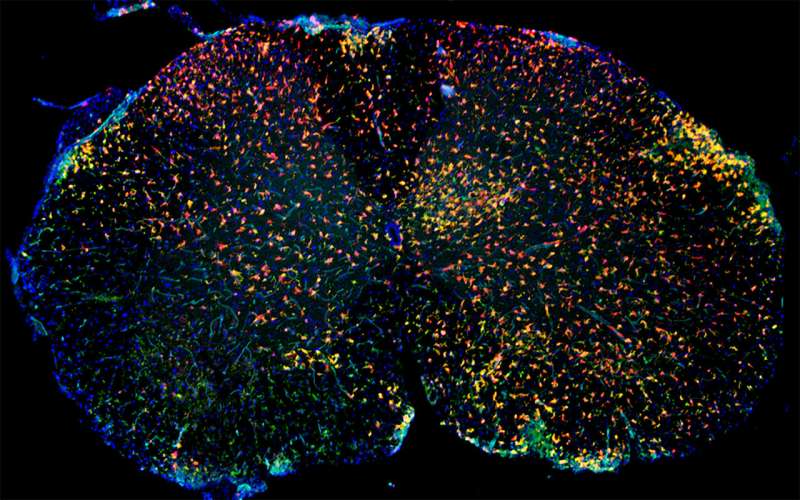 Newly discovered immune cells play role in inflammatory brain diseases