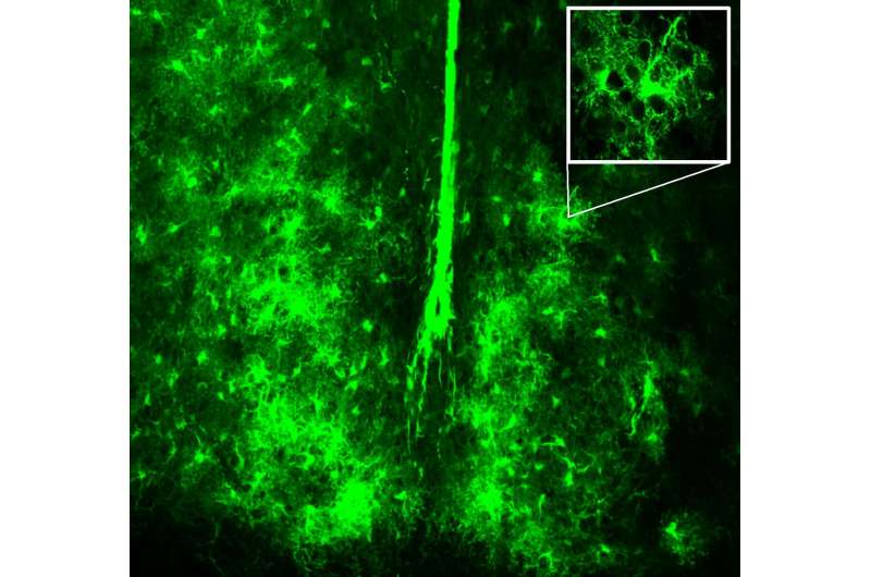 New role for brain's support cells in controlling circadian rhythms
