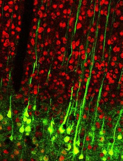New study in mice reveals unexpected place for learning, memory in the brain