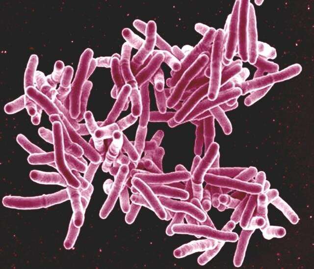 Tuberculosis micobacteriana