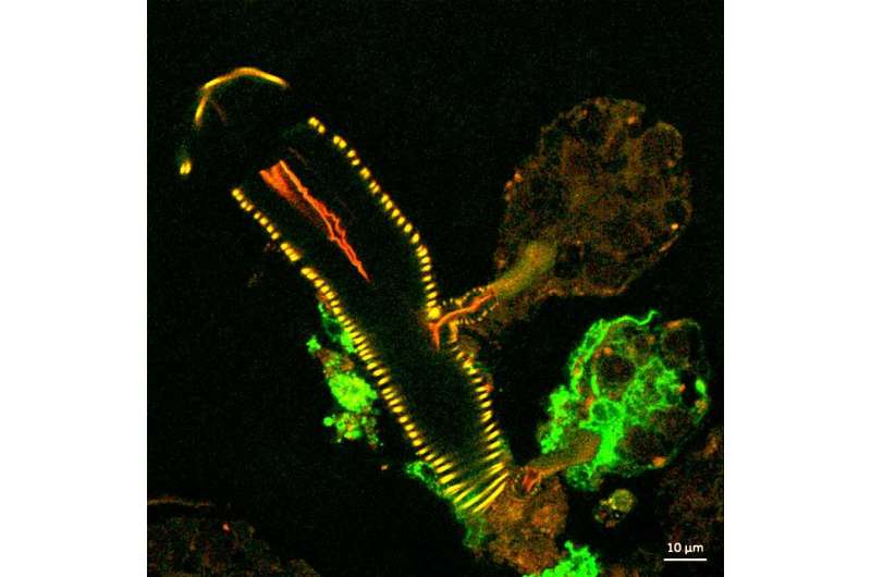 NIH scientists explore tick salivary glands as tool to study virus transmission and infection