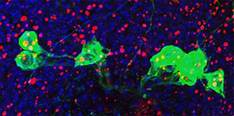 NIH study implicates hyperactive immune system in aging brain disorders