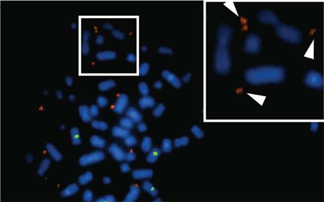 Non-coding DNA located outside chromosomes may help drive glioblastoma