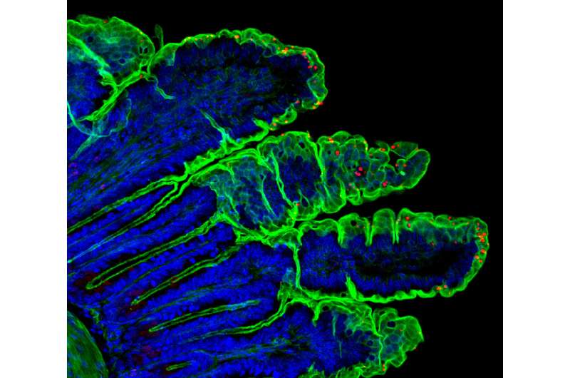Novel model for studying intestinal parasite could advance vaccine development