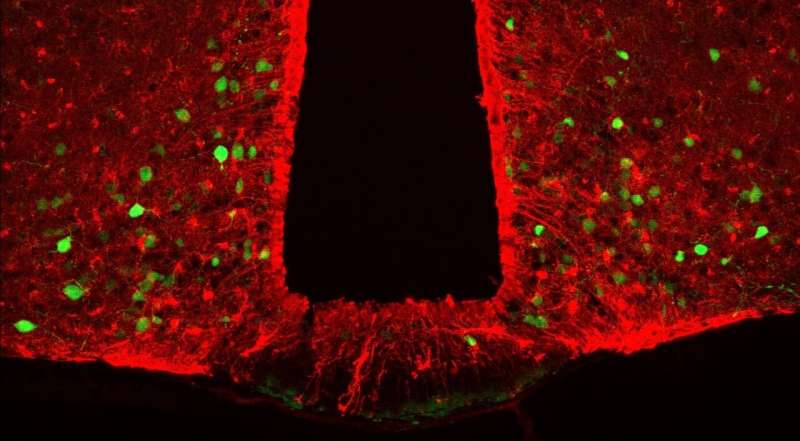 Obesity: The key role of a brain protein revealed