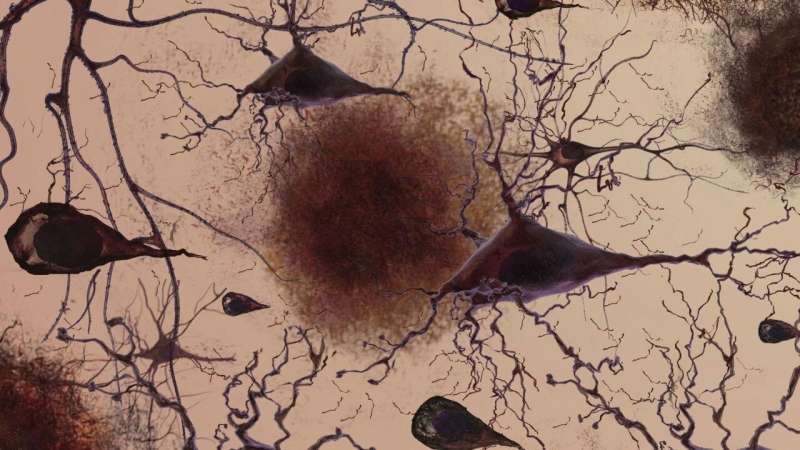 Objective subtle cognitive difficulties predict amyloid accumulation and neurodegeneration