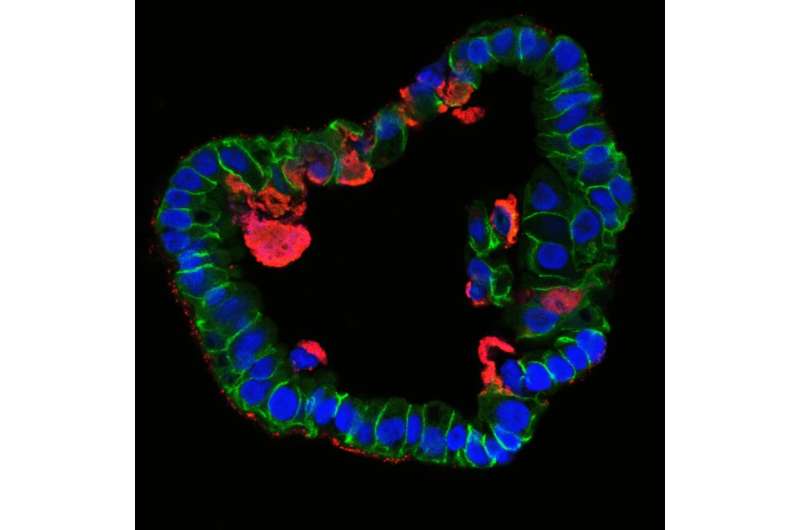 Organoids reveal inflammatory processes in chlamydia infections