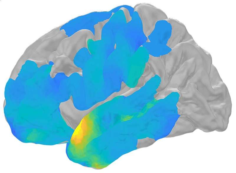 Our brains may ripple before remembering
