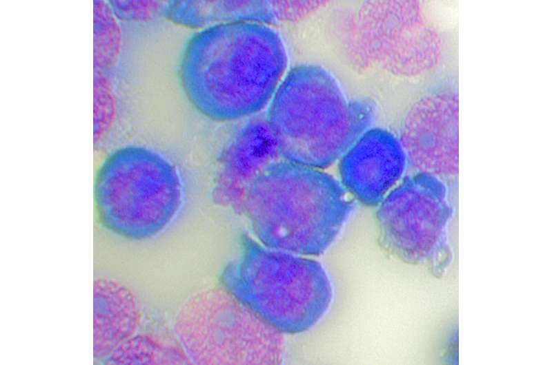 Overlooked molecular machine in cell nucleus may hold key to treating aggressive leukemia