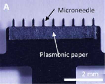 Painless skin patch collects fluid for diagnostic testing