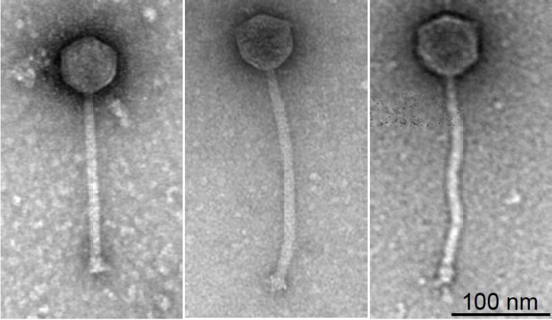 Phage therapy treats patient with drug-resistant bacterial infection