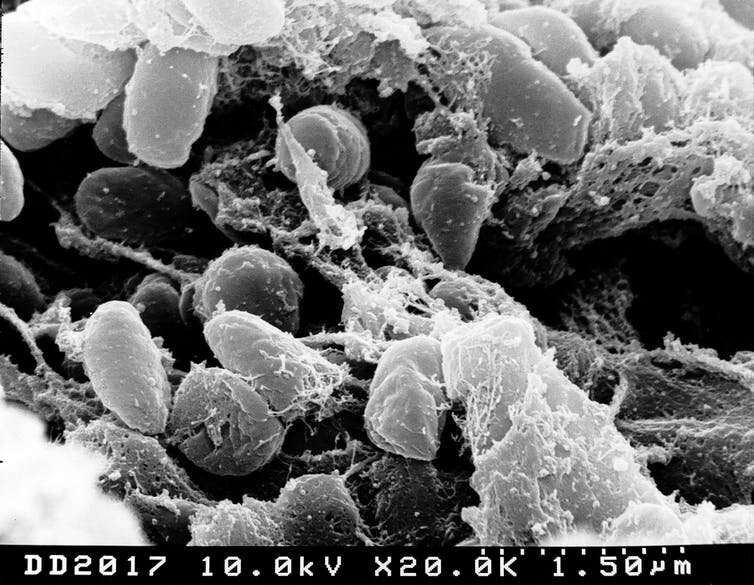 Plague was around for millennia before epidemics took hold – and the way people lived might be what protected them
