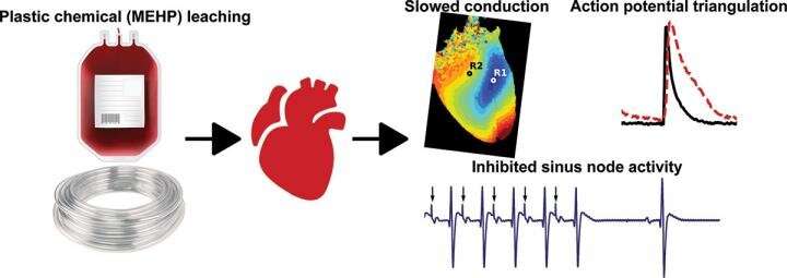 Plasticizer interaction with the heart