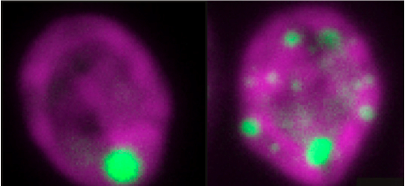 Princeton researchers explore how a carbon-fixing organelle forms via phase separation