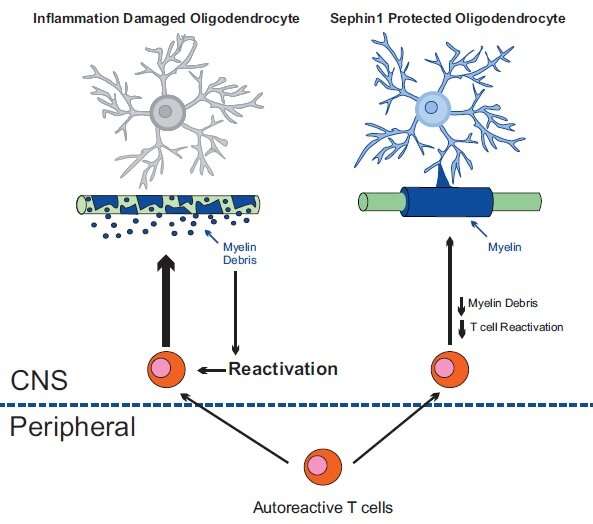 Protecting oligodendrocytes may reduce the impact of multiple sclerosis