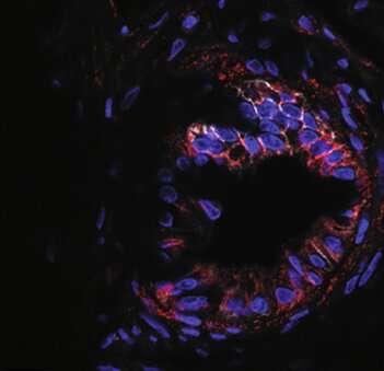 Protein could offer therapeutic target for pancreatic cancer