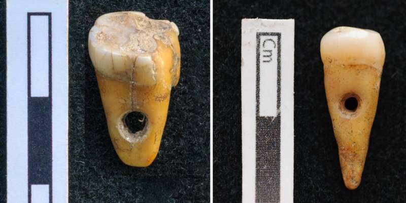 Rare find: human teeth used as jewellery in Turkey 8,500 years ago