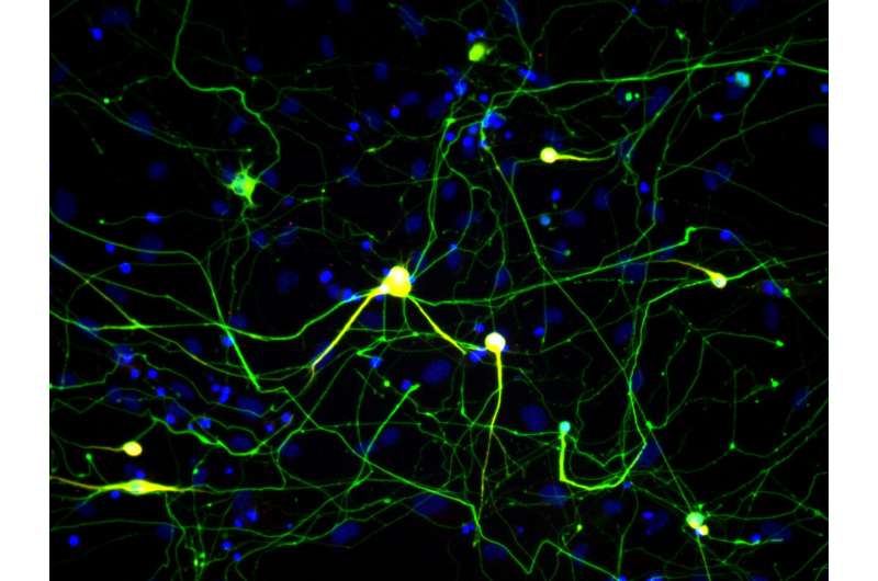 Research confirms nerve cells made from skin cells are a valid lab model for studying disease