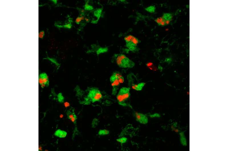 Retinal prion disease study redefines role for brain cells
