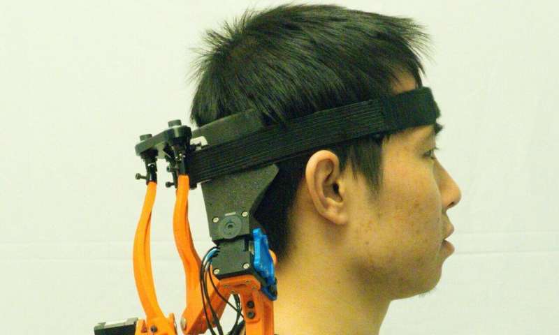 Robotic neck brace dramatically improves functions of ALS patients