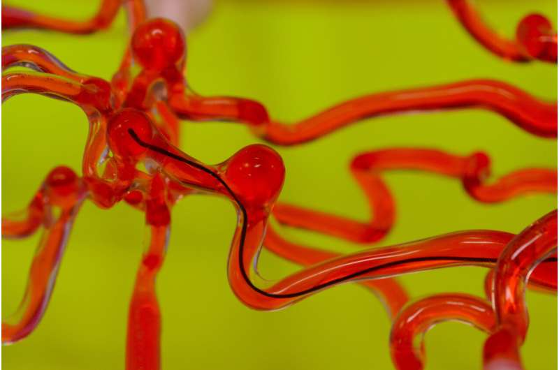 Robotic thread is designed to slip through the brain's blood vessels