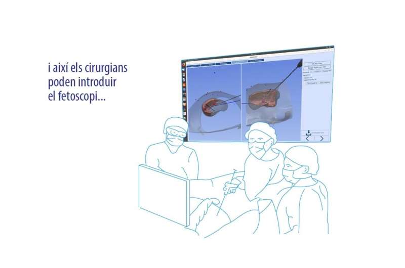 Sant Joan de Deu and Clinic with UPF create a surgical navigation system for fetal surgery