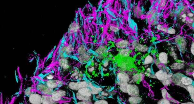 科学家生成，跟踪产生髓磷脂的脑细胞的发展