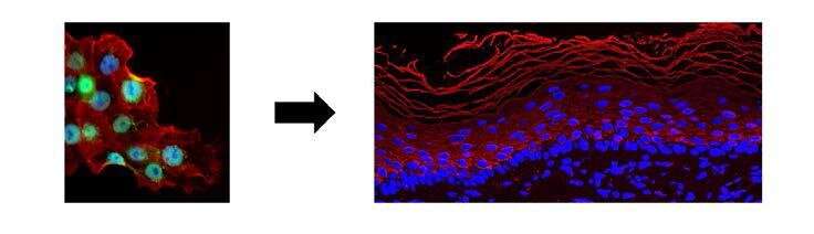Skin graft: a new molecular target for activating stem cells