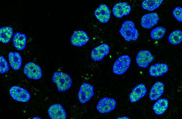 Slug, a stem cell regulator, keeps breast cells healthy by promoting repair of DNA damage