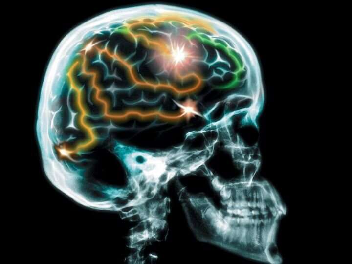 Smart brain stimulators: Next-gen parkinson’s disease therapy