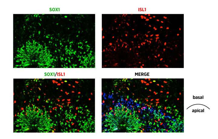 Spinal organoids mimic neurodegenerative disease