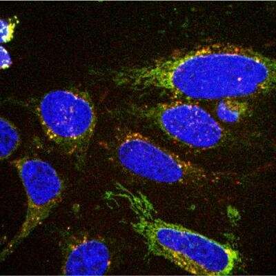 Spying on cells eating habits could aid cancer diagnosis